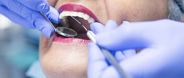 Best Emergency Tooth Extraction in Warren, MN