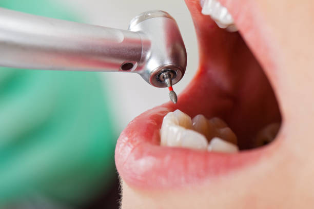 Best Emergency Denture Repair in Warren, MN